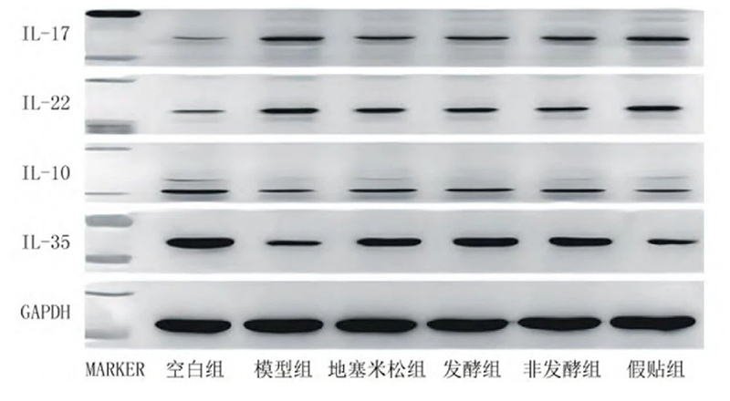 空白組和支氣管哮喘各組大鼠肺組織中IL－17、IL－22、IL－10、IL－35蛋白表達電泳圖